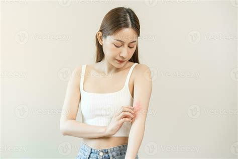 Dermatology Asian Young Woman Girl Allergy Allergic Reaction From