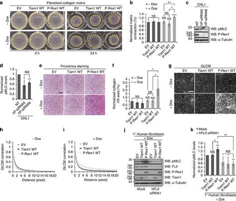 FLII is required for P-Rex1-driven cell contraction. (a)... | Download ... 