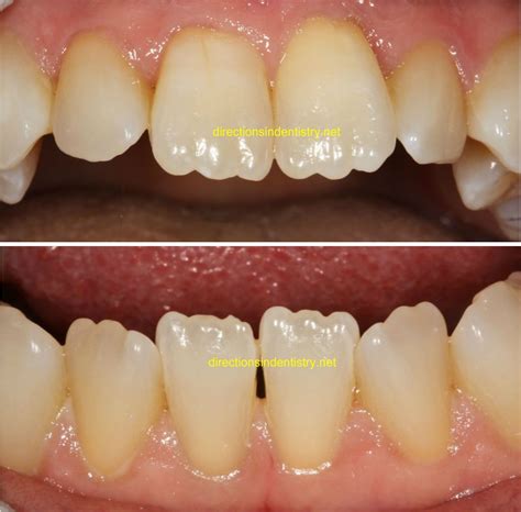 Pin On Dental Photos