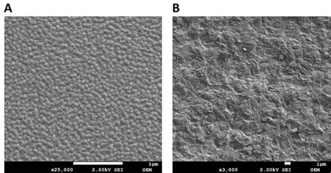 A Cryo SEM Micrographs Of Formulation N3 Labrasol Transcutol System