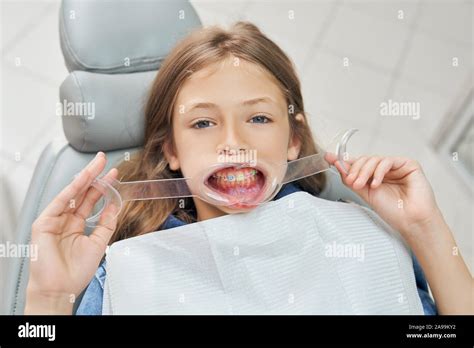 Retractor Hi Res Stock Photography And Images Alamy
