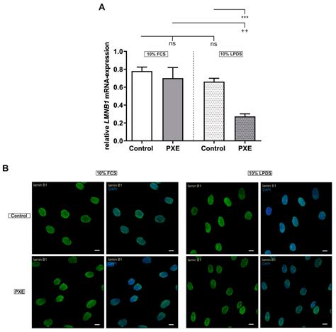 Ijms Free Full Text Linking Abcc6 Deficiency In Primary Human Dermal Fibroblasts Of Pxe