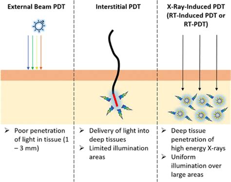 Combining Radiotherapy Rt And Photodynamic Therapy Pdt Clinical