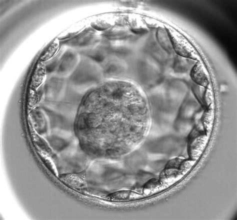 Embryo transfer at the blastocyst stage improves pregnancy and live ...