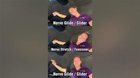 Median Nerve Exercises Carpal Tunnel Syndrome Cervical Radiculopathy