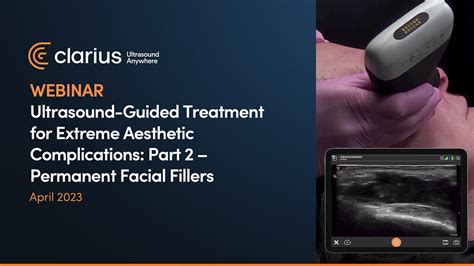 Ultrasound Guided Treatment For Extreme Aesthetic Complications Part