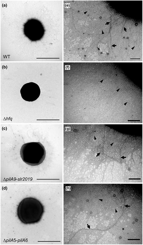 Electron Micrographs Of Different Negatively Stained Synechocystis