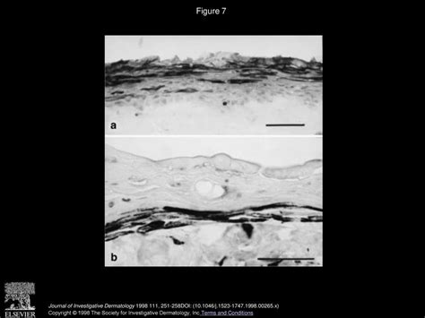 Characterization Of Epidermal Wound Healing In A Human Skin Organ