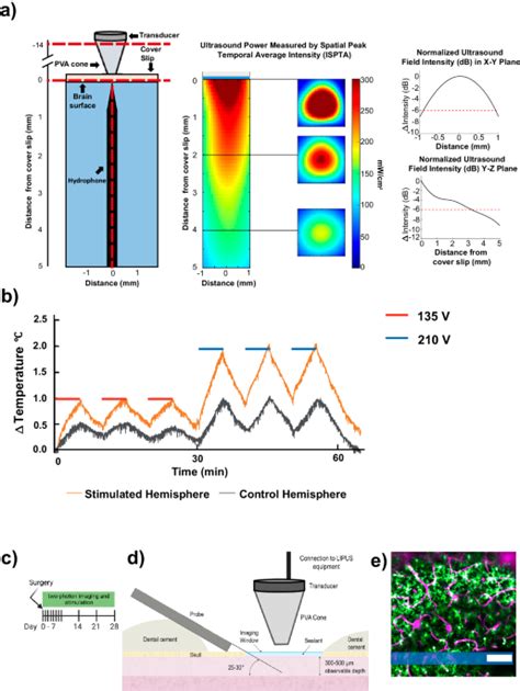 Low Intensity Pulsed Ultrasound Stimulation Lipus Modulates