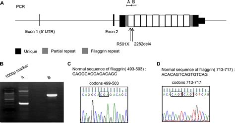 Thymic Stromal Lymphopoietin Downregulates Filaggrin Expression By