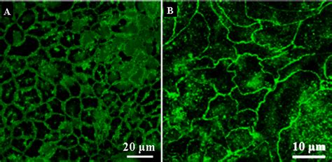 Immunofluorescent Confocal Images Of Tight Junction Protein Occludin