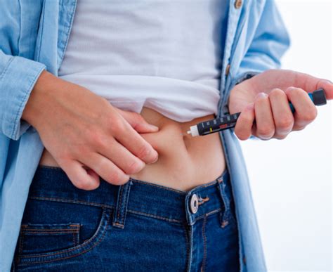 Entenda O Tratamento A Laser Para Plicoma Anal Fisioderme