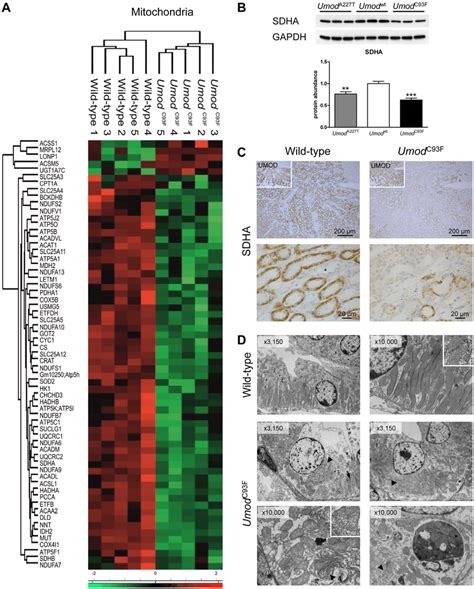 Disturbance Of Mitochondrial Homeostasis In ADTKD UMOD A Z Score