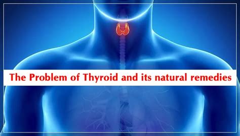 The Problem Of Thyroid And Its Natural Remedies Healthmug