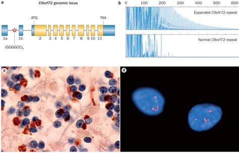 Expanded Ggggcc Hexanucleotide Repeat In Noncoding Region Of C Orf