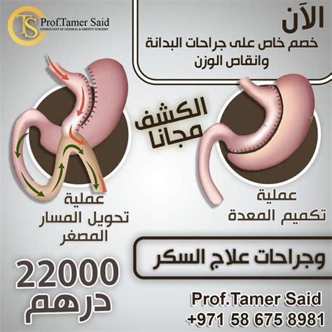 Offer • عيادة الأستاذ الدكتور تامر سعيد لجراحات السمنة والسكر