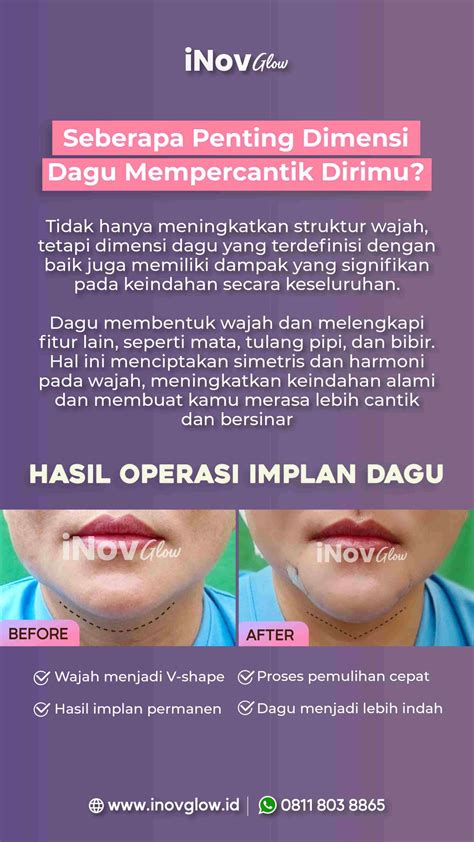 Before After Operasi Dagu V Shape Inovglow Klinik Spesialis Bedah