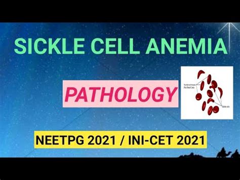 Sickle Cell Anemia Pathology Sickle Cell Crisis Neet Pg