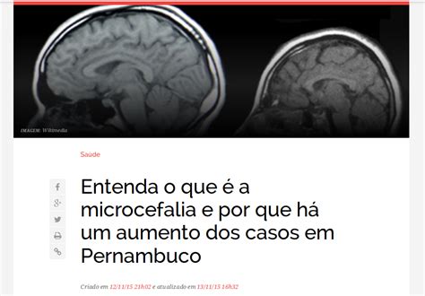 SURTO DE MICROCEFALIA EM 42 MUNICÍPIOS DE PERNAMBUCO Sarau Para Todos