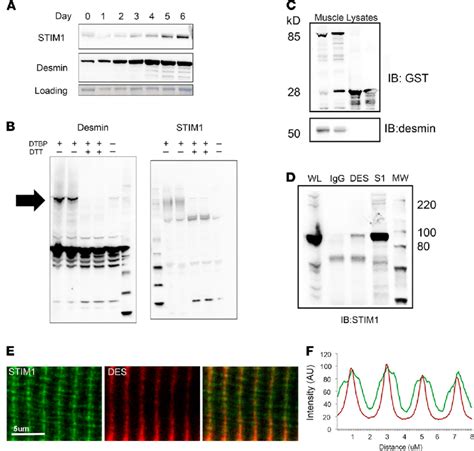 Interaction Between STIM1 And Desmin In The Skeletal Muscle A C2C12