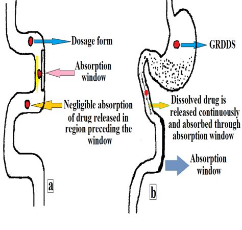 A Conventional Drug Delivery Systems B Gastroretentive Drug