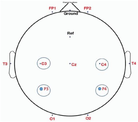 Amplitude Integrated Eeg Aeeg Obgyn Key