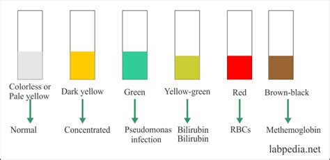 Urine Analysis Part Urine Analysis Urine Physical Characters