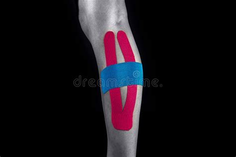 Medical Taping For Calcaneal Spur And Plantar Fasciitis Treatment