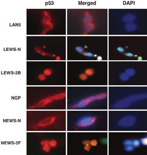 Localization Of P53 By Immunofluorescence Cell Lines Were Grown To