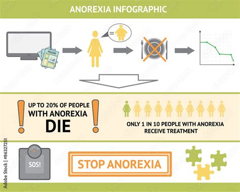 Anorexia Nervosa Vector Infographic Information And Statistics Causes