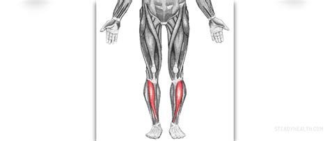 Sore leg muscles | General center | SteadyHealth.com