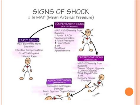 Shock Circulatory Shock