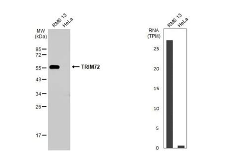 TRIM72 Antibody HL1855 Azide and BSA Free Novus Biologicals 100 μL