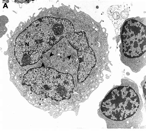 Ultrastructure Of Normal And Itp Megakaryocytes Download Scientific