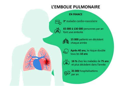 Embolie Pulmonaire Cause Sympt Mes Traitement