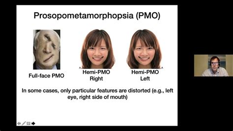 Prof Brad Duchaine on "Prosopometamorphopsia: Face distortions as a ...