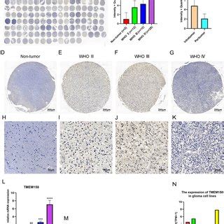 Tmem Mrna Is Highly Expressed In Idh Wt Gbms And Is Correlated With