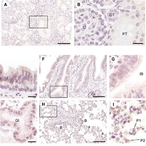 Photomicrographs Of Immunohistochemical Analysis Of Human Nsdhl