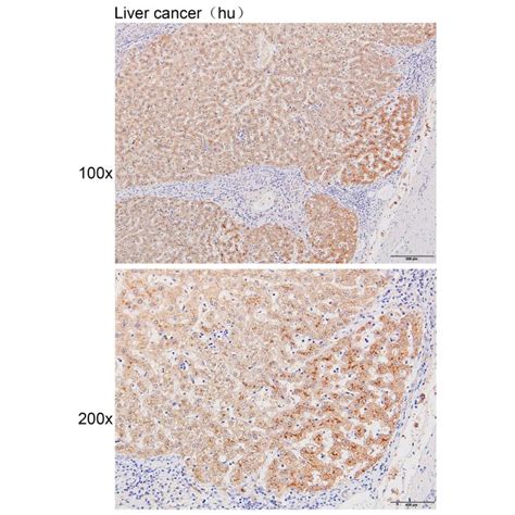 Solarbio K111079P Anti PFKL Polyclonal Antibody 试剂仪器耗材