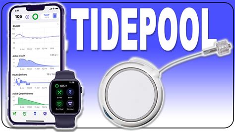 New Pump Uses Tidepool Loop How It Works Youtube