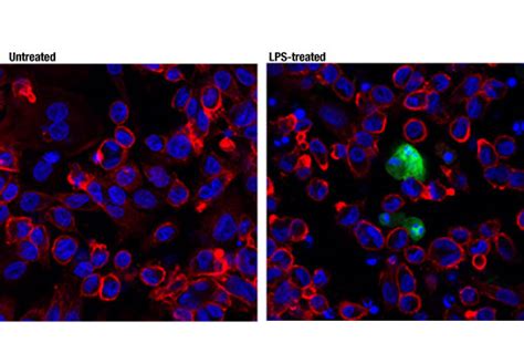 Cleaved Il 1β Asp116 D3a3z Rabbit Mab Cell Signaling Technology