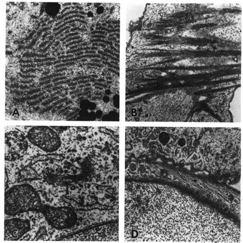 Transmission Electron Micrograph Of Human Sertoli Cells In Culture A