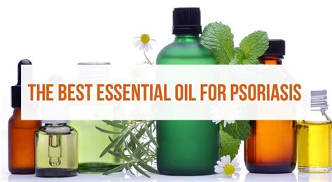 Best Essential Oil For Psoriasis March 2021 Reviews And Top Picks