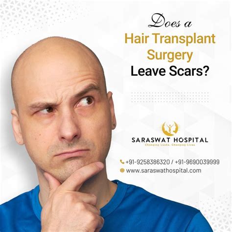 Best Hair Transplant In Ahmedabad Artofit