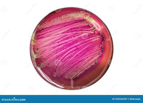 Escherichia Coli Bacterial Colonies On Macconkey Agar Media Imagen De