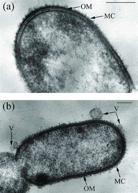 Transmission Electron Micrographs Of Ultrathin Sections Of Cells Of