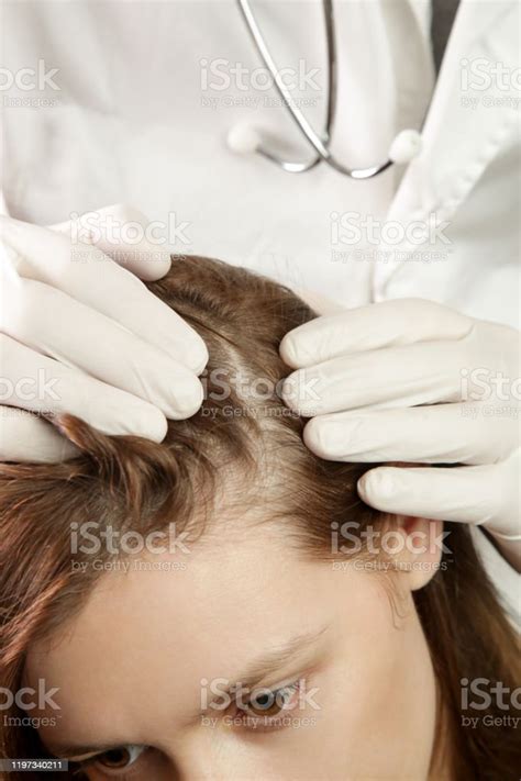 Doctor Examining Womans Hair Scalp Scalp Eczema Dermatitis Psoriasis