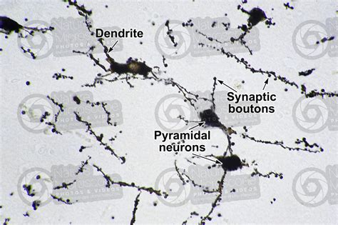 Mammal Cerebral Cortex Neuron Silver Stain X Neuron Mammals