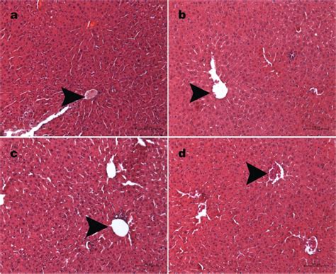 Histopathology Of The Liver Upon Administration Of Sprague Dawley Rats