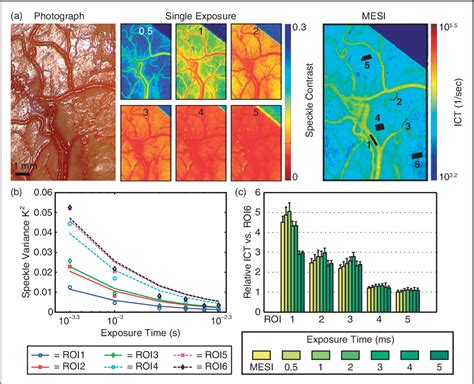 Figure 3 From Intraoperative Multi Exposure Speckle Imaging Of Cerebral